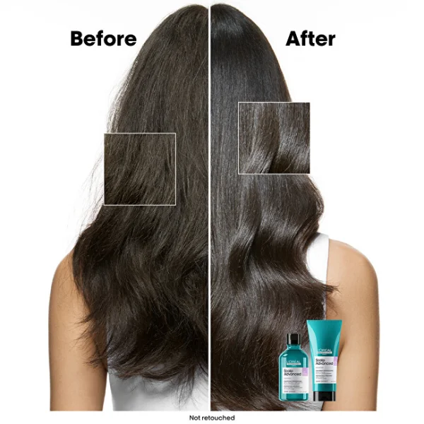Scalp advanced anti-discomfort professional shampoo thumbnail 8