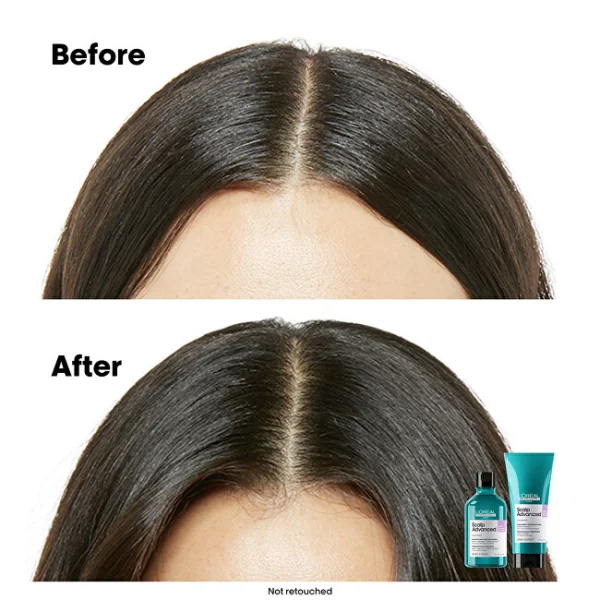 Scalp advanced anti-discomfort professional shampoo thumbnail 10