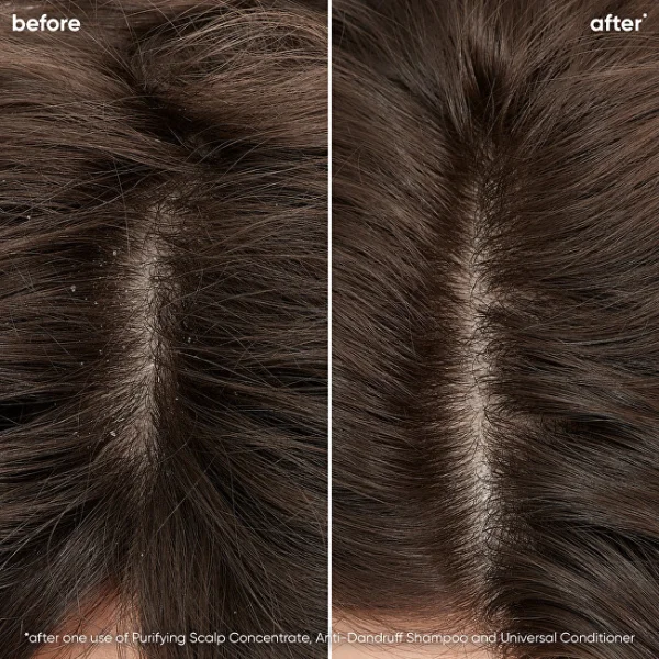 Scalp sync purifying concentrate thumbnail 3