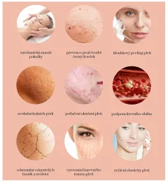 BeautyRelax Cosmetic device for skin abrasion Peelmax thumbnail 8