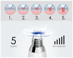 BeautyRelax Cosmetic device for skin abrasion Peelmax thumbnail 6