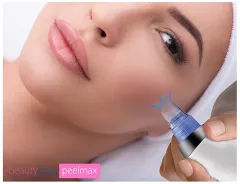 BeautyRelax Cosmetic device for skin abrasion Peelmax thumbnail 7