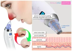 BeautyRelax Cosmetic device for skin abrasion Peelmax thumbnail 5